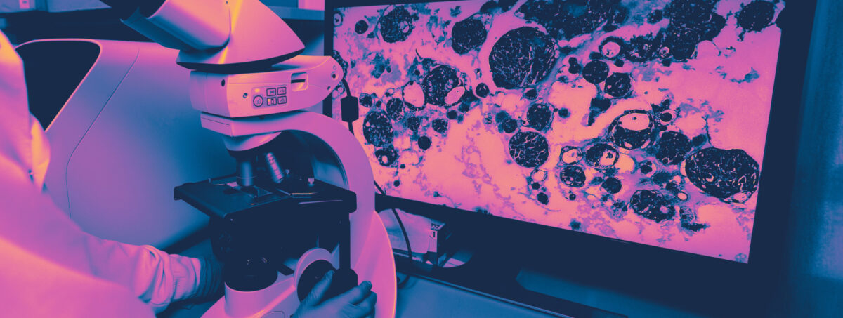 Colorized image of a microscope in front of a screen that's is displaying the sample that is being viewed